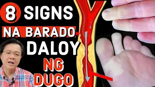 8 Signs na Barado Daloy ng Dugo (Poor Circulation) - Payo ni Doc Willie Ong #1179