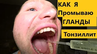 Как я промываю гланды (миндалины)