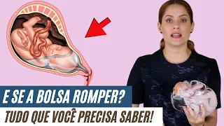 Tudo o que você precisa saber sobre o rompimento da bolsa no trabalho de parto | Bolsa Rota