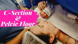 C-section versus natural birth and my vagina