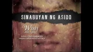 Wish Ko Lang: Muling pagbisita kay Mico, ang binatang sinabuyan ng asido