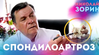 Спондилоартроз. Ответы на вопросы зрителей