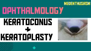 OPHTHALMOLOGY | KERATOCONUS & KERATOPLASTY