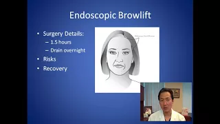 How Can I Lift My Droopy Eyebrows - Browlift Consultation - Dr. Anthony Youn