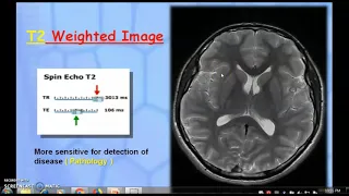 PART-1 MAGNETIC RESONANCE IMAGING  |RECORDED WEBINAR|