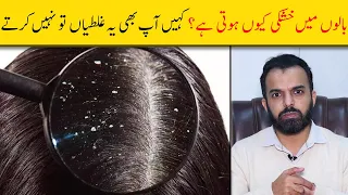 HOW TO TREAT DANDRUFF FAST AT HOME - Dandruff Medical and Home Remedies - How to Get Rid of Dandruff