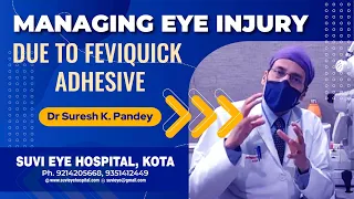 Managing Eye injury due to Feviquick  adhesive by Dr Suresh K Pandey SuVi Eye Hospital Kota Raj.