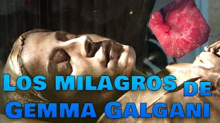 Los milagros de Santa Gema Galgani