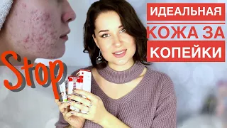 ИДЕАЛЬНАЯ КОЖА ЗА КОПЕЙКИ/ ЭФФЕКТИВНЫЕ СРЕДСТВА ОТ ПРЫЩЕЙ и ШЕЛУШЕНИЙ НА КОЖЕ