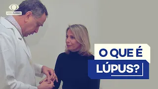 Você sabe o que é lúpus? Entenda causas, sintomas e tratamentos