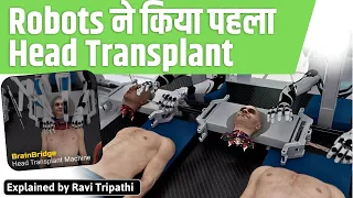 World's first head transplant robotic surgery successfull