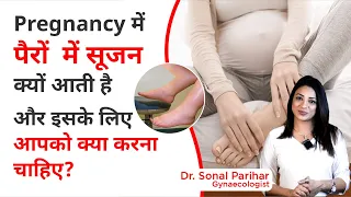 Swollen legs during pregnancy | प्रेगनेंसी में पैरो में सूजन क्यों आती है ? Sonal Parihar