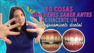 10 COSAS que DEBES SABER antes de BLANQUEAR TUS DIENTES - Dra.Joana Campolargo