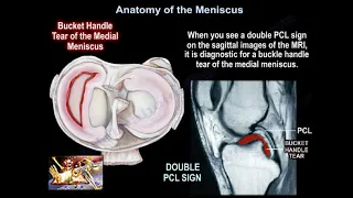 Meniscus TEARS- Everything You Need To Know - Dr. Nabil Ebraheim