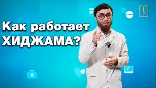 Хиджама, мифы и современная медицина. Доктор Биляль