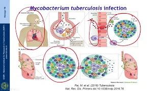 4 Pathogenesis of TB Session 01