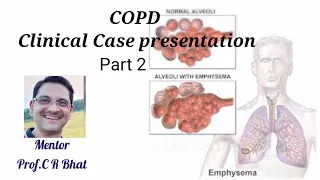 COPD Clinical case presentation - Part 2