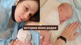 Мои роды 🐣 тазовое предлежание | последствия