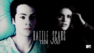 Battle Scars | Teen Wolf