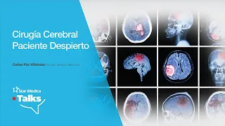 Cirugía Cerebral: Paciente Despierto