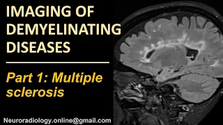 Imaging of Multipe Sclerosis