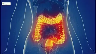 🥩 Laura ha iniziato una dieta chetogenica: ecco cosa è successo al suo intestino