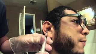 Draining my cauliflower ear