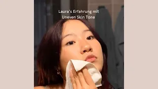 Filabé Erfahrung - zur Lösung von Hautproblemen mit Laura