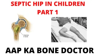 SEPTIC HIP JOINT IN CHILDREN - PART 1 - EPISODE 18
