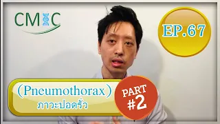 ภาวะปอดรั่ว: Part 2 (Pneumothorax) โดยนายแพทย์จักรีวัชร