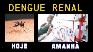 Como a Dengue ATACA os RINS ? Como Tratar ?