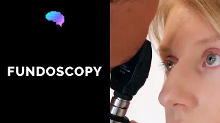 Fundoscopy (Ophthalmoscopy) - OSCE Guide