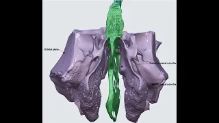 Ethmoid Bone 3D Anatomy