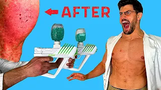 Creating the WORST GEL BULLETS INJURY of all Time | Extreme Gel Blaster & Splatter Ball Experiment