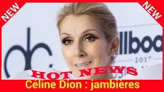Céline Dion : jambières transparentes, robe très courte et foulard dans les cheveux