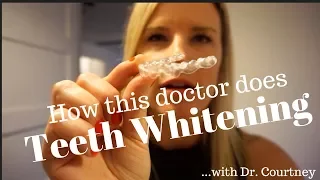 HOW TO WHITEN YOUR TEETH 2024 | How to apply teeth whitening gel in your retainers and Invisalign