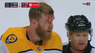 Gabriel Landeskog Bloodies Mattias Ekholm After Ekholm Rips Mikko Rantanen's Helmet Off