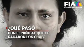 ¿#QuéPasóCon Fernandito, el niño al que su madre le sacó los ojos?