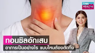 “ทอนซิลอักเสบ” อาการเป็นอย่างไร แบบไหนที่ต้องตัดทิ้ง l TNN HEALTH l 10 06 66