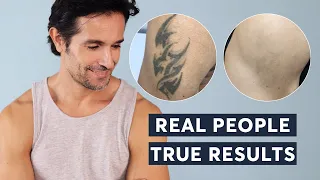 Laser Tattoo Removal  |  Real People, True Results 2023