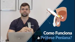 Como Funciona a Prótese Peniana? - Dr Marco Túlio Cavalcanti