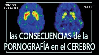 Las CONSECUENCIAS de la Pornografía en el CEREBRO