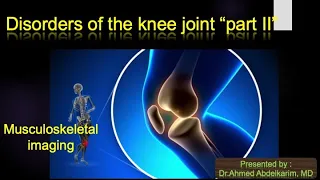 12-Disorders of the knee joint part II