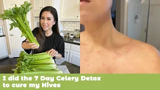 I did the 7 Day Celery Detox to cure my Hives | MyHealthyDish