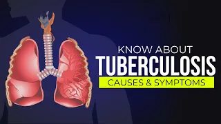 Tuberculosis (TB) | Causes and Symptoms of Tuberculosis