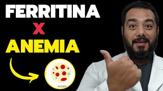 Qual valor de ferritina pode ser considerado anemia? | Prof. Dr. Victor Proença - IBAP Cursos