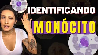 Como Identificar o Monócito - Leucocito agranular - Linfócito atípico - Bastonete - não confunda