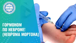 💉 «Уколоться и забыть»!? Дипроспан при невроме Мортона, поможет ли?