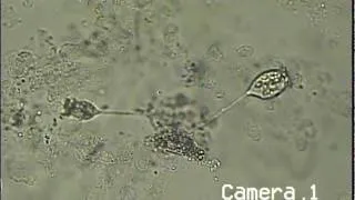 vorticella