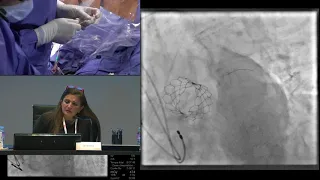 [TCTAP 2018] Coronary Symposium - Live Case & Lecture Session II